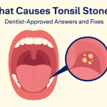 What Causes Tonsil Stones? Dentist-Approved Answers and Fixes